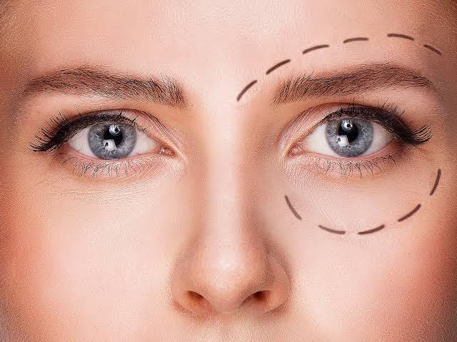 Chirurgie des paupières supérieures à Paris